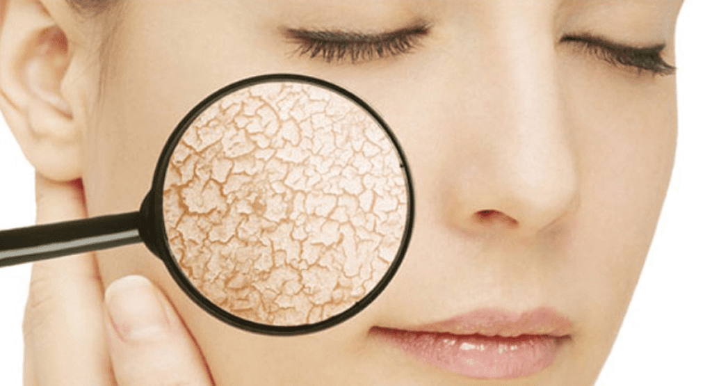 فواید سبوس برنج پایدار شده در سلامت پوست